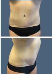 After body